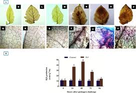 Pokala ravi kiran, md, facs, fascrs. Structural And Functional Dissection Of Differentially Expressed Tomato Wrky Transcripts In Host Defense Response Against The Vascular Wilt Pathogen Fusarium Oxysporum F Sp Lycopersici Abstract Europe Pmc
