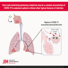 Shall try to present in a series of sketches only the episodes that seem to me to be the most interesting and important. Chest Pain Mimicking Pulmonary Embolism May Be A Common Presentation Of Covid 19 In Ambulant Patients Without Other Typical Features Of Infection Harrison Journal Of Internal Medicine Wiley Online Library