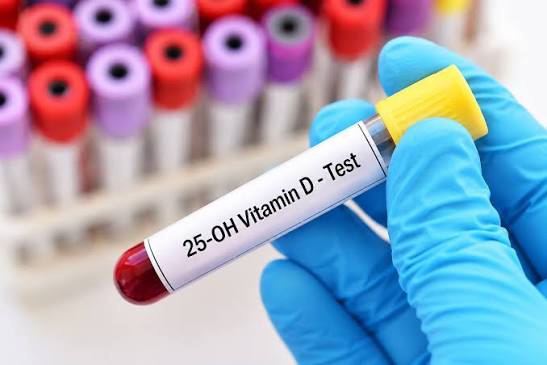 NHỮNG ĐIỀU CẦN BIẾT KHI XÉT NGHIỆM VITAMIN D 👇👇👇