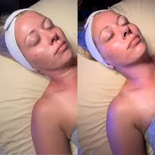 Glow Therapy Esthetics