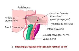 Image result for Glomus tumor