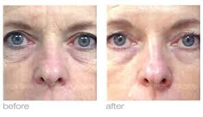 2 Skin Care Institute For Facial Rejuvenation And Nourishment Chemical Peel Skin Bleaching Skin Discoloration