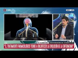 La esclerosis lateral amiotrófica (ela) (también conocida como la enfermedad de lou gehrig) es una enfermedad de las las células que controlan la actividad muscular voluntaria (neurona motora), progresiva, que causa problemas con el control muscular y el movimiento.12 hay varios tipos de. Esclerosis Lateral Amiotrofica Ela Sintomas Diagnostico Y Tratamiento Youtube