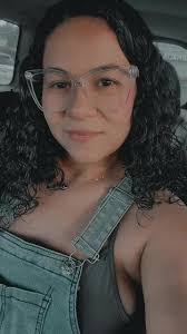 Michelle Colon Amputee