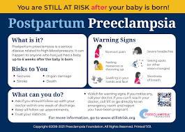 Image result for Mild PIH Management