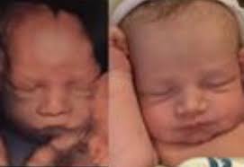 Maybe you would like to learn more about one of these? 3d Ultrasound Hd Ultrasound In Chicago