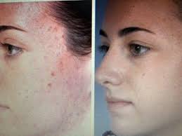 YSBeautybar, 668 N Orlando Ave, Ste 1022, Maitland, FL 32751, US