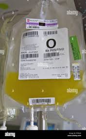 Image result for Platelet Transfusion