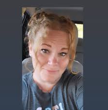 Diet for chronic venous insufficiency?