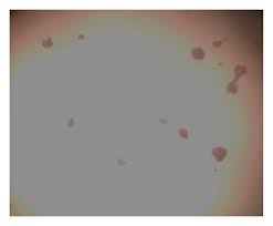 Image result for Triumfetta welwitschii