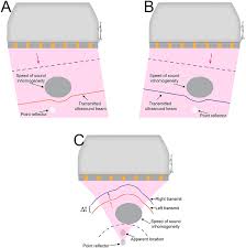 Ultrasonic Sound Speed Estimation for Liver Fat Quantification: A Review by  the AIUM-RSNA QIBA Pulse-Echo Quantitative Ultrasoun
