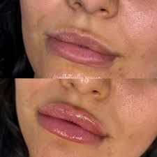 Ana Paula Aun, MMS, PA-C (@aesthetically_anaaun) • Instagram photos and  videos