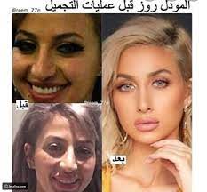 أعيذكَ بكلماتِ الله التامات يا صاحبي من أن يكسركَ في هذا العالم شيء، ومن أن يمسكَ سوء، ومن أن تنطفىءَ قبل أوانك، ومن أن تُؤتى من قِبلِ قلبكَ، فمن هناك مصارعُ الرِّجال! Ù…ÙˆØ¯Ù„ Ø±ÙˆØ² Ù‚Ø¨Ù„ Ø¹Ù…Ù„ÙŠØ© Ø§Ù„ØªØ¬Ù…ÙŠÙ„