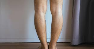 Should Adults Have Their Bow Leg Condition Corrected? | Hss