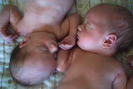 Baby Contact Dermatitis Symptoms Causes Treatment Waterwipes Uk