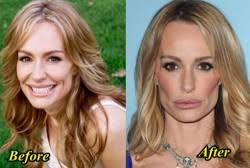 Résultat de recherche d'images pour "maria bartiromo implants"