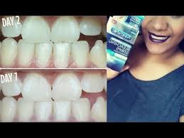 Von backpulver und natron über zitronensaft und erdbeeren bis hin zu öl und salz: Weisse Zahne In 7 Tagen Zu Hause Aufhellen Rapid White Express 5 Minuten Bleaching Strips Review Youtube