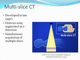 Multislice Ct Scan Ppt Ct Scan Machine
