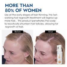 Pastes and pomades will generally work the best for guys with fine and thin hair types. Anti Hair Loss Products Hair Growth Spray Essential Oil Liquid For Men Women Hair Growth Essence Serum Hair Care Repair Growing Hair Loss Products Aliexpress