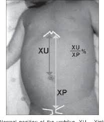 Image result for Umbilicus