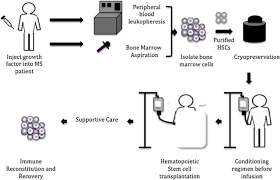 Hematopoietic stem cell transplantation (hsct) involves the intravenous (iv) infusion of autologous or allogeneic stem cells to reestablish hematopoietic function in patients whose bone marrow or immune system is damaged or defective. Autologous Hematopoietic Stem Cell Hsc Transplantation In Multiple Download Scientific Diagram