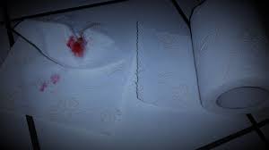 Erfahrungsbericht zum thema blut im stuhl: Hamorrhoiden Bluten 7 Tipps Die Blutung Im Stuhl Zu Stoppen