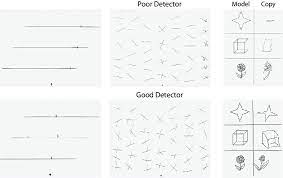 Line bisection and unilateral visual neglect in patients with neurologic impairment. Line Bisection Test Printable 1 Bisector Line Cancellation Test Printable Line Bisection Test Sample Line Bisection Easy Print Bisection Symbol Tas Line Bisection Left Hemispatial Using The Printable Spring Coloring