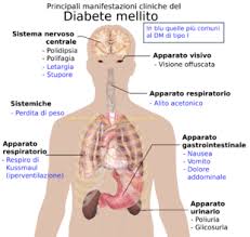 In generale, chi soffre di diabete di tipo 2 deve seguire un'alimentazione a basso contenuto di acidi grassi saturi e colesterolo e con modeste quantità di carboidrati, preferibilmente. Diabete Mellito Di Tipo 2 Wikipedia