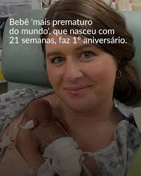 Nash Keen, o bebê mais prematuro do mundo, entrou para o Guinness Book of  World Records em 5 de julho de 2024, após nascer com apenas 21 semanas de  gestação (cerca de