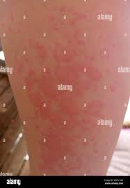 Image result for Wheal