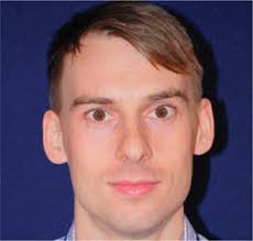 Lower Extremity Stiffness: Effects