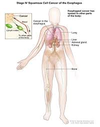 Pin On Blood Pressure Remedies