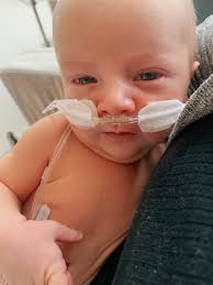 Horse's high respiration rate after exercise