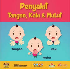 Penyakit tangan, kaki dan mulut. Penyakit Tangan Kaki Dan Mulut Hfmd Pusat Kesihatan Universiti
