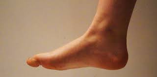 Quels sont les traitements d'une douleur à la cheville ? La Cheville Ou Cou De Pied Traitee Par L Osteo