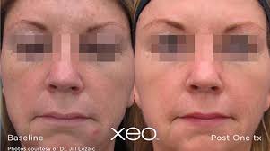 Austin Laser Aesthetics