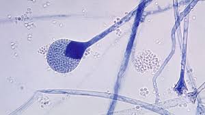 La mucormicosis, que tiene una tasa de mortalidad media del 54 %, ha sido detectada en casi 9.000 pacientes en el país asiático hasta el sábado. Hongo Negro 5 Preguntas Clave Sobre La Infeccion Fungica Que Ataca A Pacientes De Covid 19 En India T13