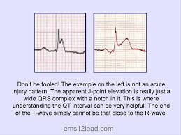 Image result for J Point