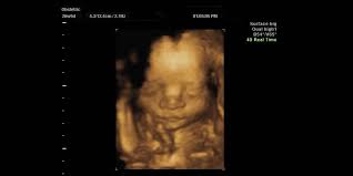 Eine neue dimension in der schwangerschaftsdiagnostik. 4d Ultraschall Nutzlich Oder Nur Vergnugen Baby Und Familie
