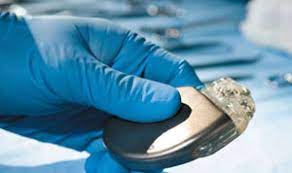 Es wird unter der haut im bereich des oberen brustkorbs (oder manchmal im bereich des bauches) implantiert. Der Implantierbare Kardioverter Defibrillator Icd