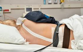 Image result for Active Labor Anesthesia