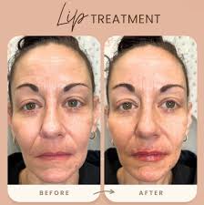 It is with a heavy heart that we let everyone know Dana's husband Tim has  passed away. Our condolences go out to Dana, Dylan, & Drew as well as the  entire Fee