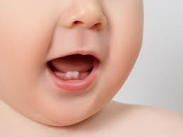 Im normalfall taucht der erste zahn um den sechsten lebensmonat auf. Zahnungsprobleme Bei Babys