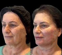 Clínica Fontana (@clinicafontana1) • Instagram photos and videos