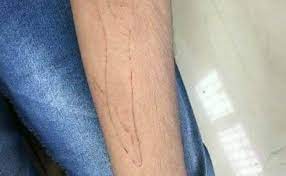 Oct 12, 2017 · best blue whale challenge games. Blue Whale Challenge Blue Whale Survivor In Puducherry 22 Shares Terrifying Details