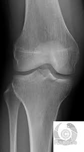 Tous Les Cas Cliniques Et E Learning En Radiologie Et Imagerie Medicale De Radeos
