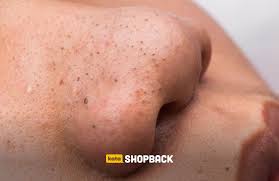 Sudah mencoba shampoo berbagai macam merk namun belum juga kelihatan hasil yang signifikan?, saatnya anda mencoba lidah buaya untuk rambut anda. 12 Manfaat Lidah Buaya Untuk Wajah Nggak Hanya Melembapkan Lho