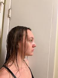 Amazing Difference After An 11k Nose Job …..🤣🤣🤣