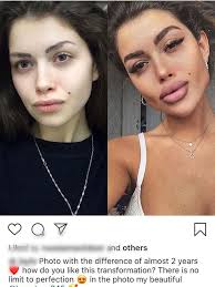 Check out plastic surgery gone wrong with before and after photos of bad celebrity plastic surgeries at womansday.com. 19 People Who Took Plastic Surgery Too Far In 2021 Plastic Surgery Gone Wrong Celebrity Plastic Surgery Botched Plastic Surgery