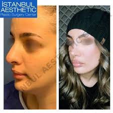 See photos, profile pictures and albums from i̇stanbul aesthetic center. Istanbul Aesthetic Center Photos Facebook